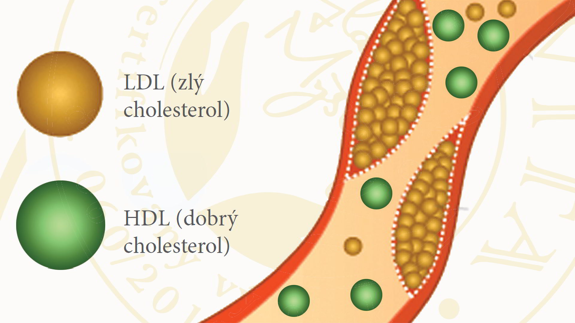 LDL a HDl cholesterol v krvi.