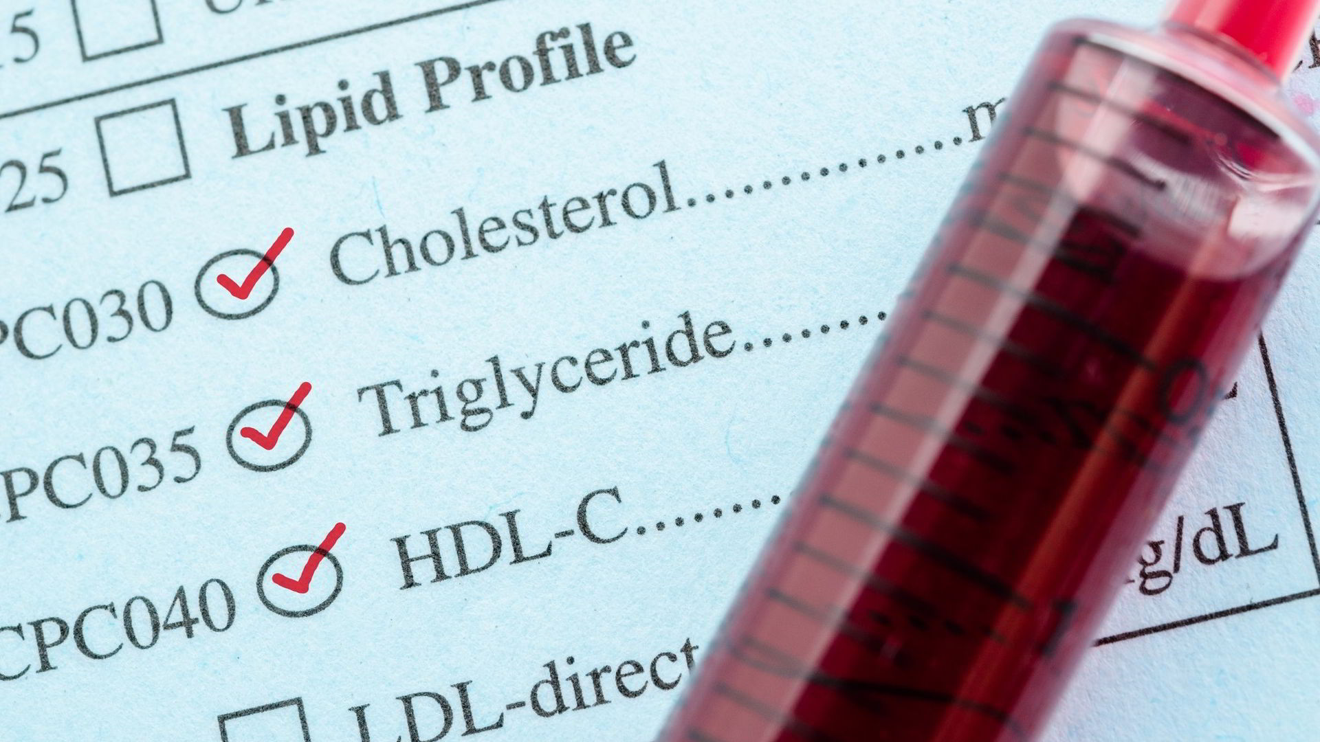 Test na HDL cholesterol.