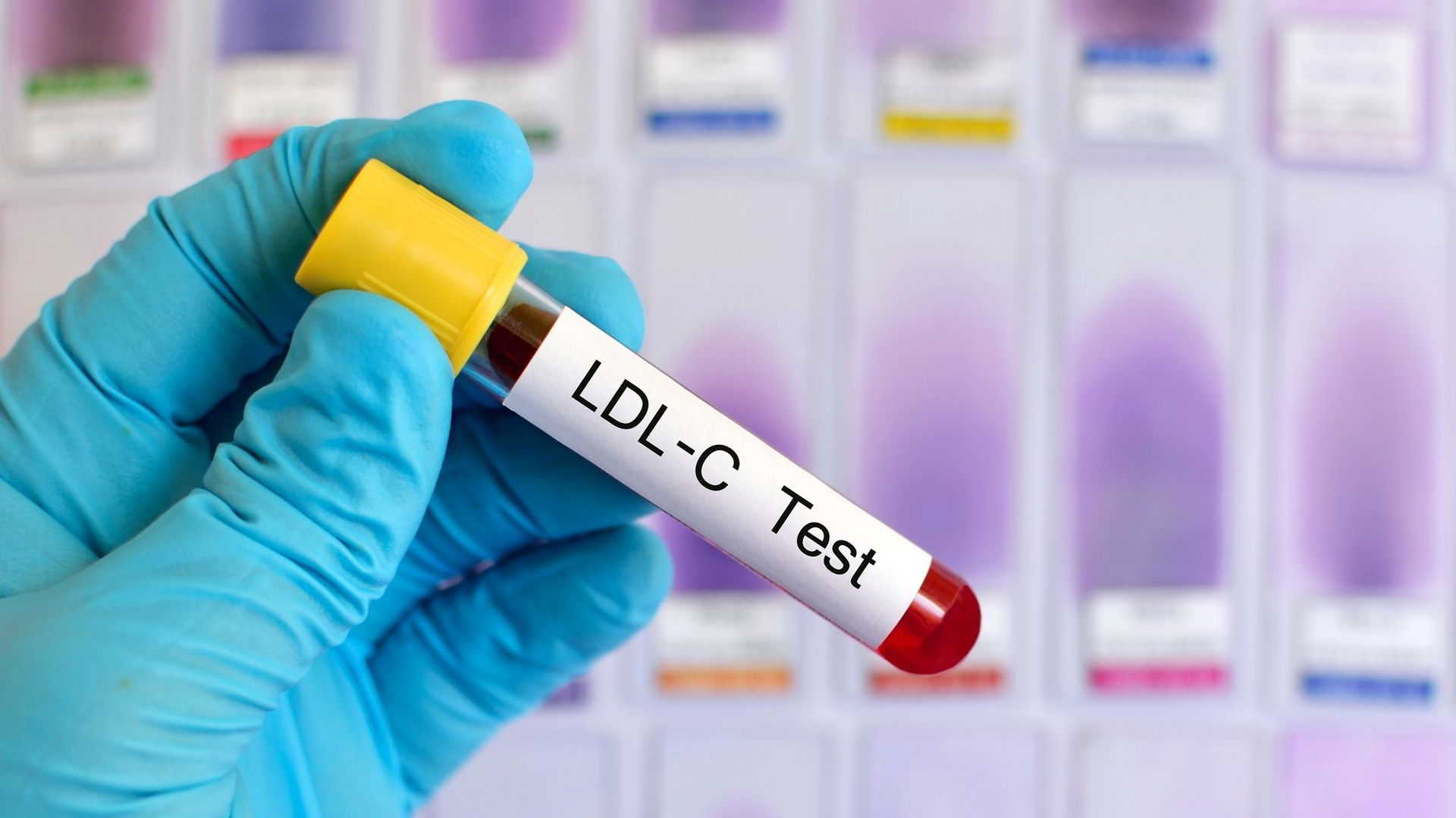 Test na LDL cholesterol.